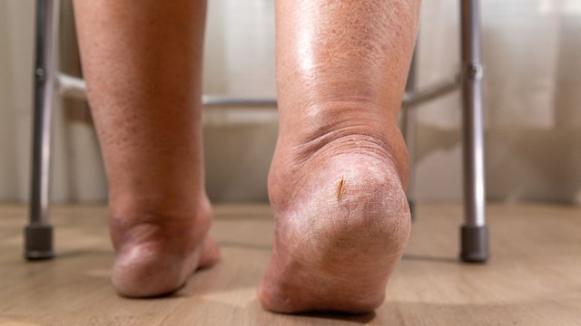 bai-viet/tim-hieu-ve-cac-phan-do-phu-nguyen-nhan-va-cach-dieu-tri.html