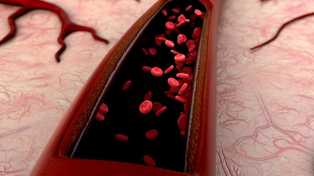 bai-viet/phan-tang-nguy-co-tang-huyet-ap-va-nhung-luu-y-nguoi-bi-tang-huyet-ap-can-biet.html