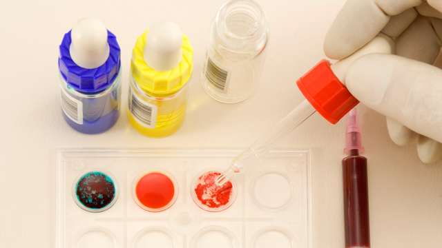 bai-viet/phan-ung-hoa-hop-trong-truyen-mau-co-y-nghia-nhu-the-nao.html