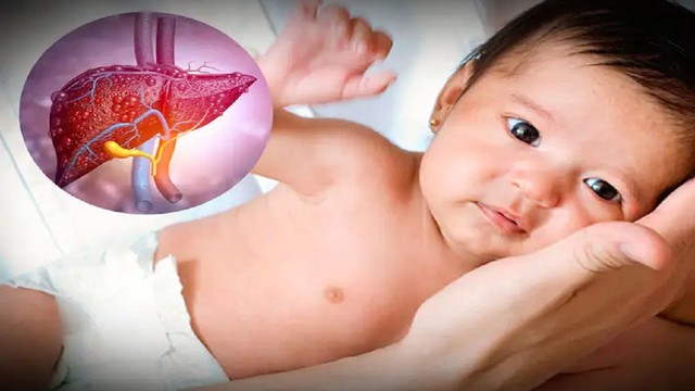 bai-viet/phong-ngua-va-dieu-tri-xo-gan-o-tre-em.html