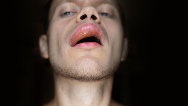 bai-viet/phu-mach-do-thuoc-nguyen-nhan-trieu-chung-va-cach-xu-ly.html