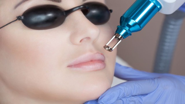 bai-viet/phun-moi-bao-lau-thi-xoa-duoc-nhung-luu-y-quan-trong-khi-xoa-phun-moi.html