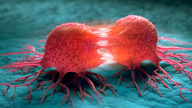 bai-viet/phuong-phap-dieu-tri-ung-thu-moi-va-nhung-dieu-can-biet-ve-dieu-tri-ung-thu.html