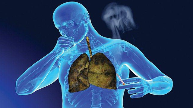 bai-viet/phuong-phap-dieu-tri-ung-thu-phoi-te-bao-nho-64648.html