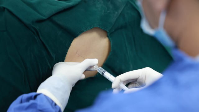 bai-viet/phuong-phap-gay-te-ngoai-mang-cung-la-gi.html