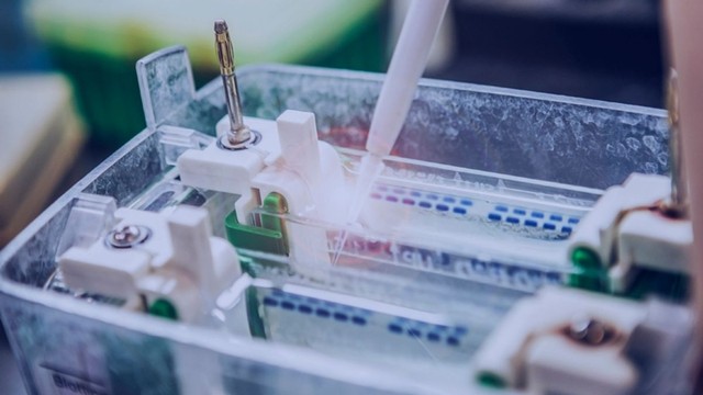 bai-viet/phuong-phap-western-blot-la-gi-ung-dung-trong-y-khoa-va-sinh-hoc.html