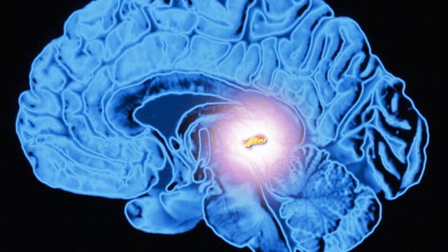 bai-viet/pineal-gland-la-gi-tim-hieu-ve-cau-tao-va-vai-tro-cua-pineal-gland-trong-co-the.html