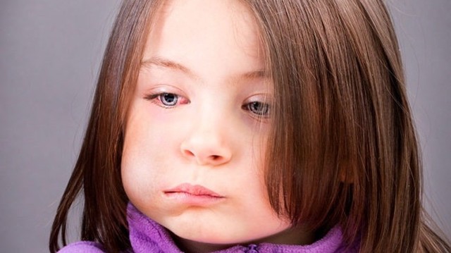 bai-viet/quai-bi-kieng-gio-quat-khong-nguyen-nhan-va-con-duong-lay-lan-benh-73266.html