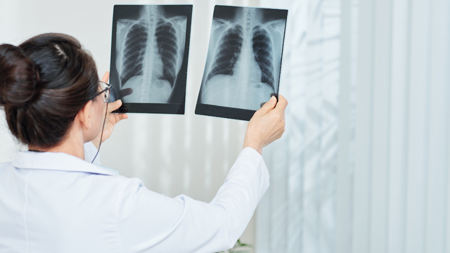 Quy trình khám và chữa bệnh tại Bệnh viện Phổi Hải Dương