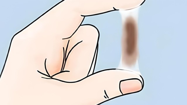 bai-viet/ra-huyet-nau-khi-mang-thai-3-thang-dau-nguyen-nhan-va-cach-khac-phuc.html