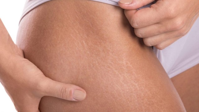 bai-viet/nguyen-nhan-va-cach-khac-phuc-tinh-trang-ran-da-dui.html