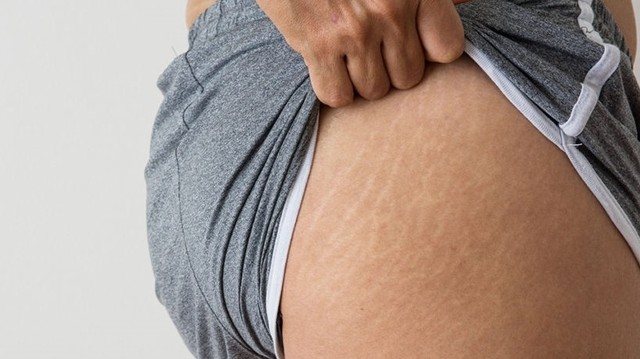 bai-viet/ran-da-mong-o-nam-tim-hieu-nguyen-nhan-va-cach-dieu-tri-57124.html