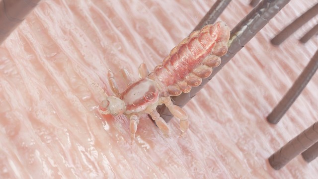 bai-viet/ran-long-mu-tu-dau-ma-co-cach-dieu-tri-va-phong-ngua-hieu-qua.html