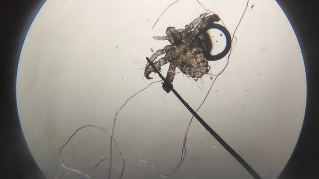 bai-viet/ran-mu-lay-qua-duong-gi-64348.html