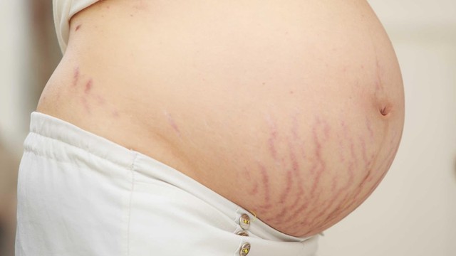 bai-viet/ran-nut-da-nguyen-nhan-va-cac-phuong-phap-dieu-tri-65100.html