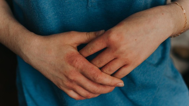 bai-viet/roi-loan-chuyen-hoa-porphyria-va-nhung-thong-tin-can-biet.html