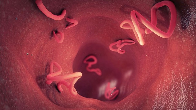 bai-viet/san-cho-va-giun-dua-cho-khac-nhau-nhu-the-nao.html