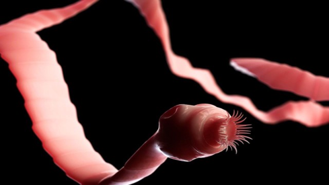 bai-viet/san-lon-co-nguy-hiem-khong-cach-phong-ngua-benh-nhu-the-nao.html