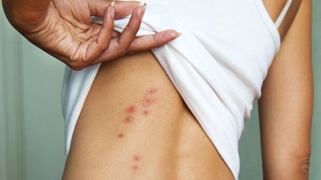 bai-viet/san-ngua-nguyen-nhan-dau-hieu-va-phuong-phap-dieu-tri.html