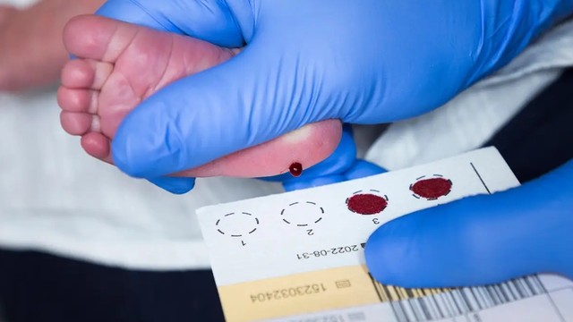 bai-viet/tim-hieu-chi-tiet-ve-sang-loc-so-sinh-goi-5-benh.html