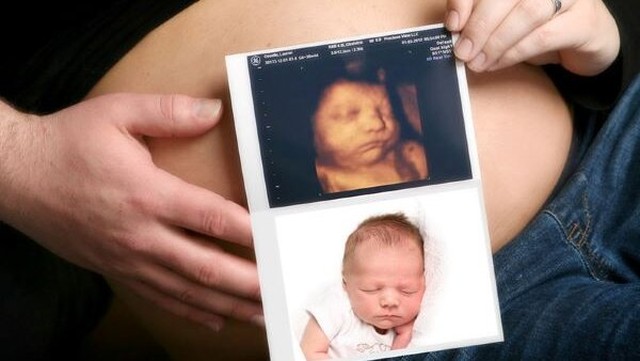 bai-viet/sang-loc-thai-12-tuan-gia-bao-nhieu.html