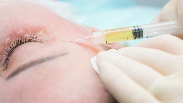 bai-viet/sau-khi-lam-prp-kieng-gi-la-tot-nhat.html