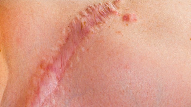 bai-viet/seo-loi-do-ngua-nguyen-nhan-va-cach-khac-phuc-55333.html