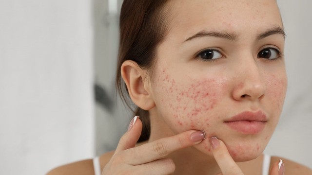 bai-viet/seo-tham-do-nguyen-nhan-va-cach-dieu-tri-seo-nhanh-nhat-62343.html