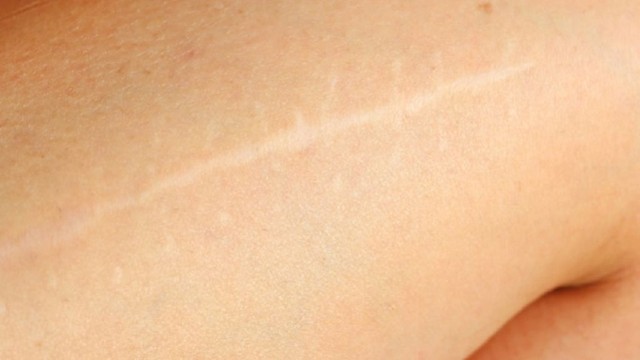 bai-viet/seo-trang-la-gi-cach-phong-ngua-seo-trang-hieu-qua.html