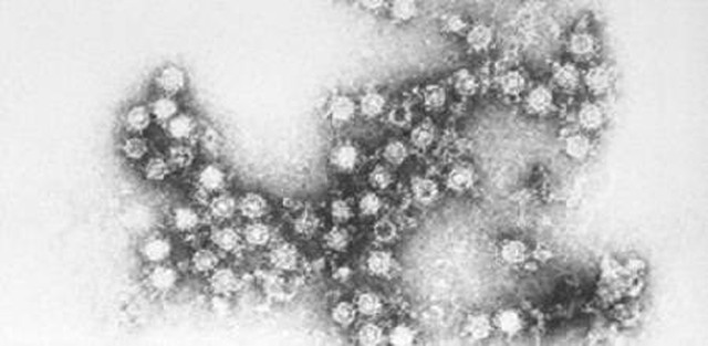 benh/viem-hong-viem-mieng-viem-tim-do-virus-coxsackie-172.html
