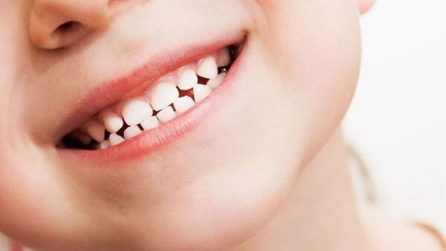 bai-viet/nguyen-nhan-nao-khien-rang-thua-ham-duoi-tac-hai-va-cach-khac-phuc-hieu-qua.html