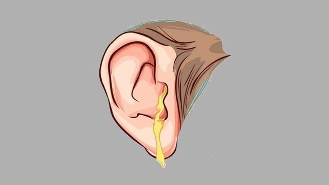 benh/chay-dich-tai.html