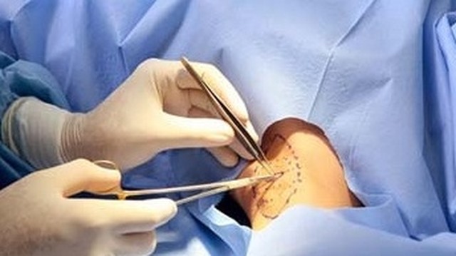 bai-viet/chi-phi-mo-u-ba-dau-la-bao-nhieu-phuong-phap-dieu-tri-u-ba-dau-hieu-qua-nhat.html