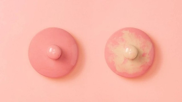 bai-viet/dau-ti-to-co-sao-khong-khi-nao-can-tham-kham-va-huong-dan-cham-soc.html