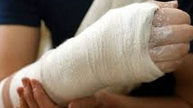 bai-viet/gay-xuong-canh-tay-bao-lau-thi-khoi-cach-cham-soc-co-the-khi-bi-gay-xuong.html