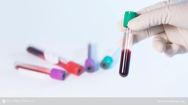 bai-viet/chi-so-triglyceride-tang-do-dau-co-anh-huong-den-mo-mau-khong.html