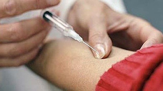 bai-viet/phuong-phap-bolus-tinh-mach-la-gi-nhung-dieu-can-luu-y-khi-bolus-tinh-mach.html