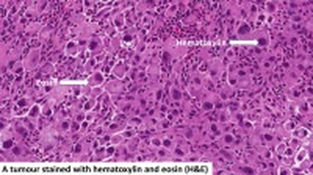 bai-viet/phuong-phap-nhuom-2-mau-hematoxylin-eosin-de-lam-gi.html