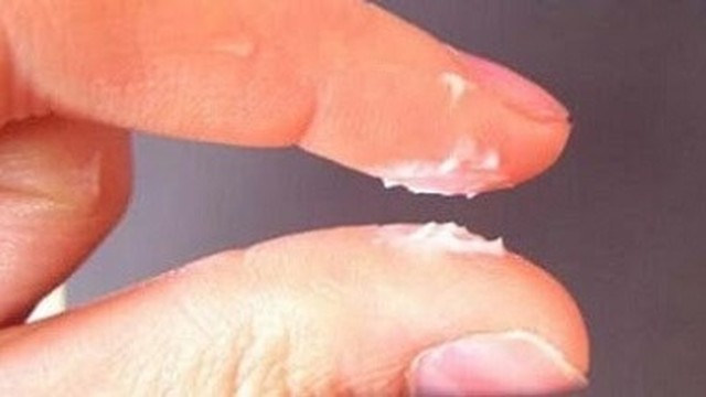 bai-viet/ra-khi-hu-mau-trang-duc-nhu-bot-la-do-dau.html