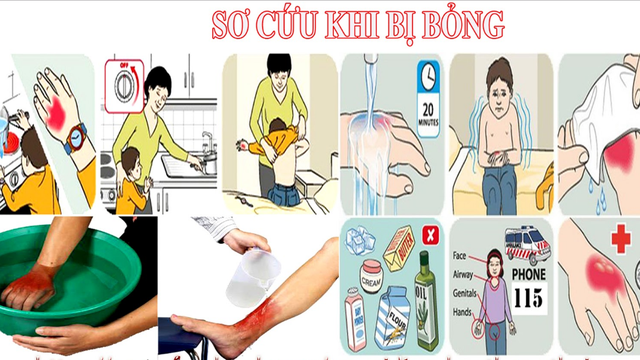 bai-viet/mot-so-truong-hop-so-cuu-bong-sai-cach-ma-nhieu-nguoi-thuong-mac-phai-52183.html