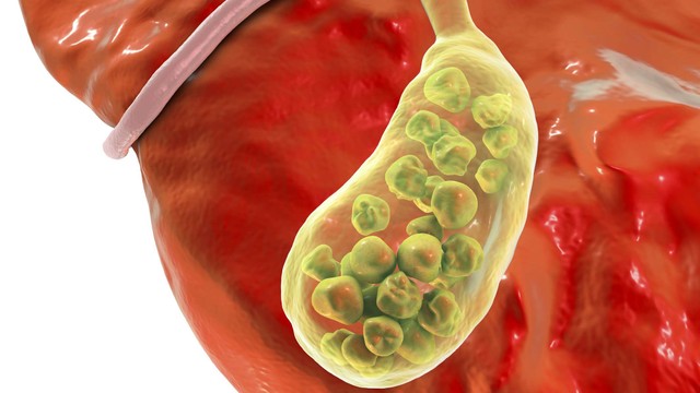 bai-viet/soi-duong-mat-trong-gan-nguy-hiem-nhu-the-nao.html