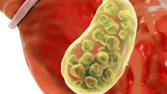 bai-viet/soi-tui-mat-10mm-co-nguy-hiem-khong-qua-trinh-cat-bo-dien-ra-nhu-the-nao.html