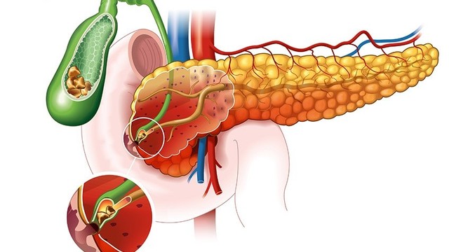 bai-viet/soi-tui-mat-12mm-co-nguy-hiem-khong-lam-gi-khi-bi-soi-tui-mat-12mm.html