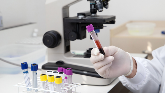 benh/soi-tui-mat.html