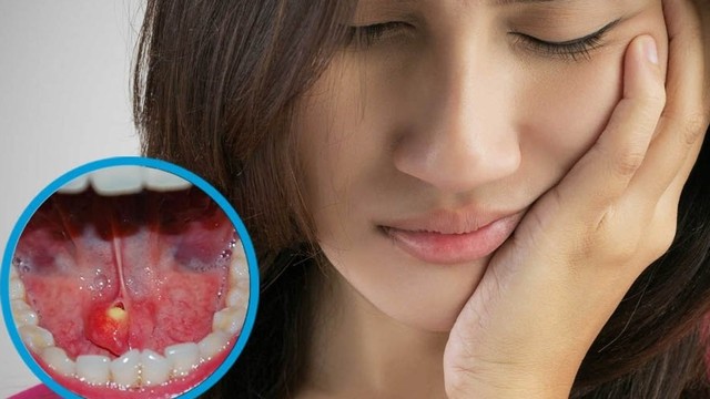 bai-viet/soi-tuyen-nuoc-bot-nhung-thong-tin-quan-trong-ban-can-biet.html