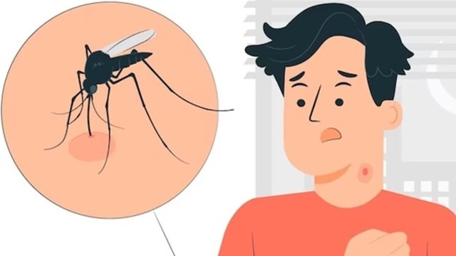 bai-viet/sot-xuat-huyet-nhiem-trung-mau-nguy-hiem-nhu-the-nao.html