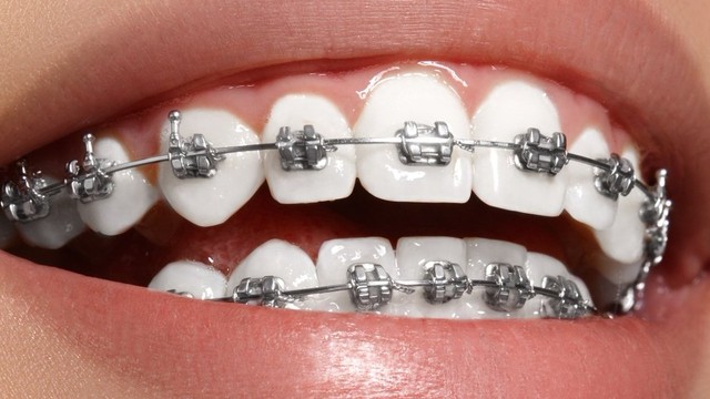 bai-viet/su-dung-mac-cai-damon-co-tot-khong.html