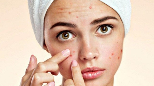 bai-viet/suc-khoe-lan-da-cach-cham-soc-da-mun-viem-khoa-hoc-nhat.html