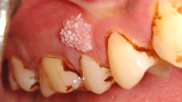 bai-viet/sui-mao-ga-o-nuou-rang-nguyen-nhan-dau-hieu-nhan-biet-va-cach-dieu-tri.html