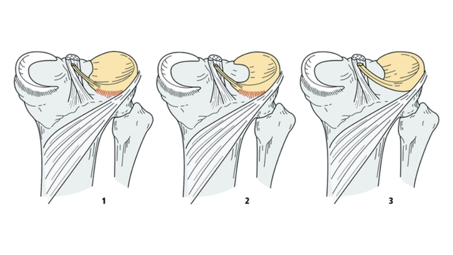 bai-viet/sun-chem-hinh-dia-co-may-loai-va-bien-phap-dieu-tri-nhu-the-nao.html
